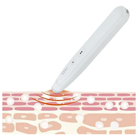 Заспокійливий пристрій Sorbo Itch Healer