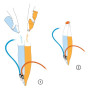 Hydrovak Source Widepac D|vide 3L